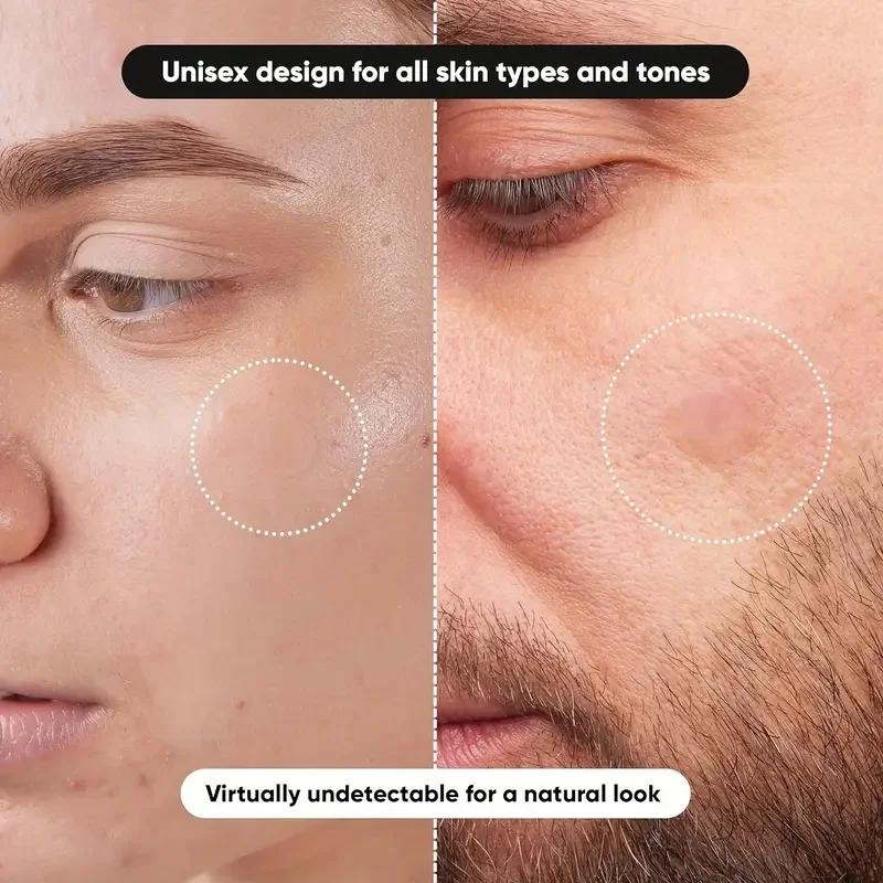 360 pieces/box acne patches -  - Face Oil ulasan dan harga