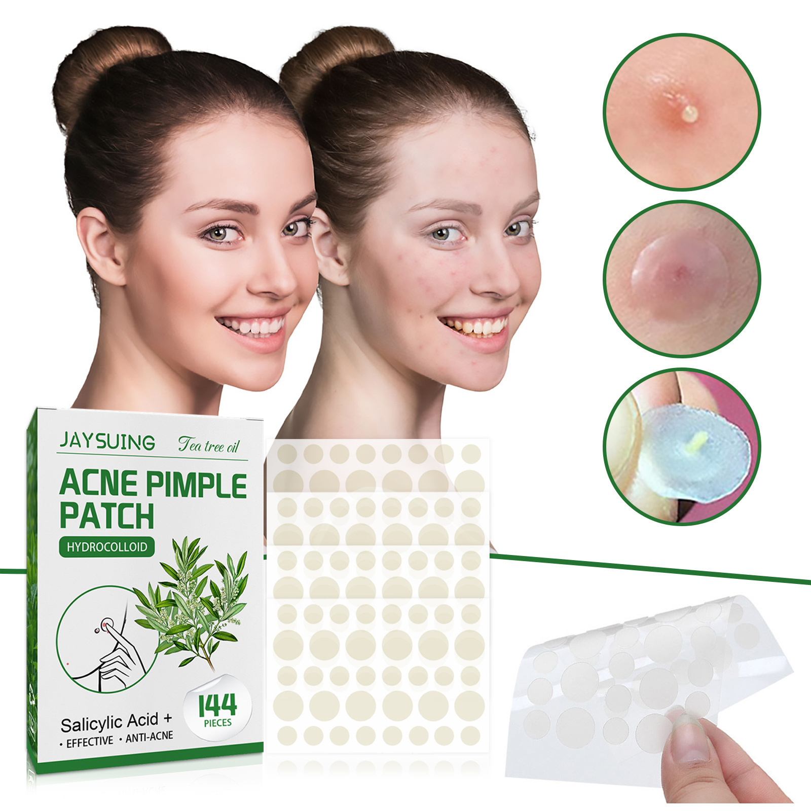 Hydrocolloid Acne Patches - Ab - Face Oil ulasan dan harga